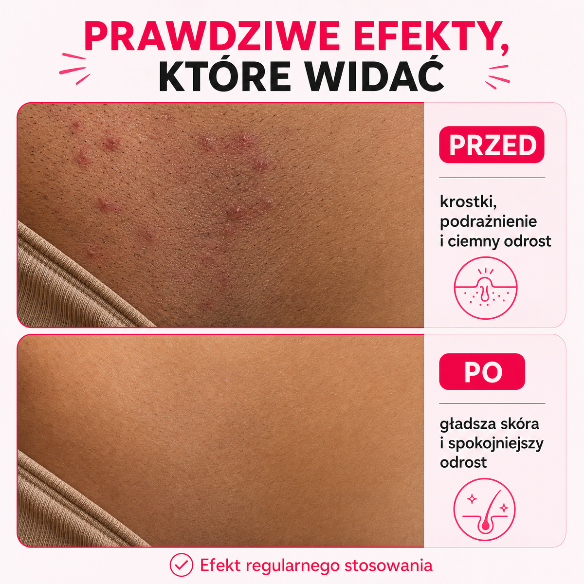 Egipski olejek przeciw porostowi włosów