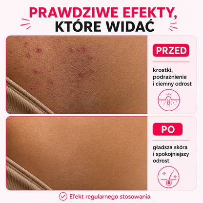 Egipski olejek przeciw porostowi włosów